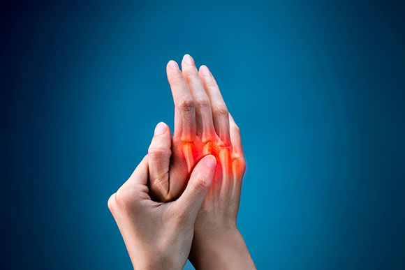 How to Care for Arthritis?