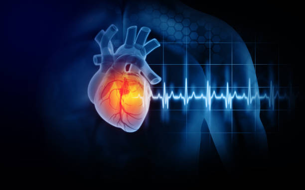 Congestive Heart Failure